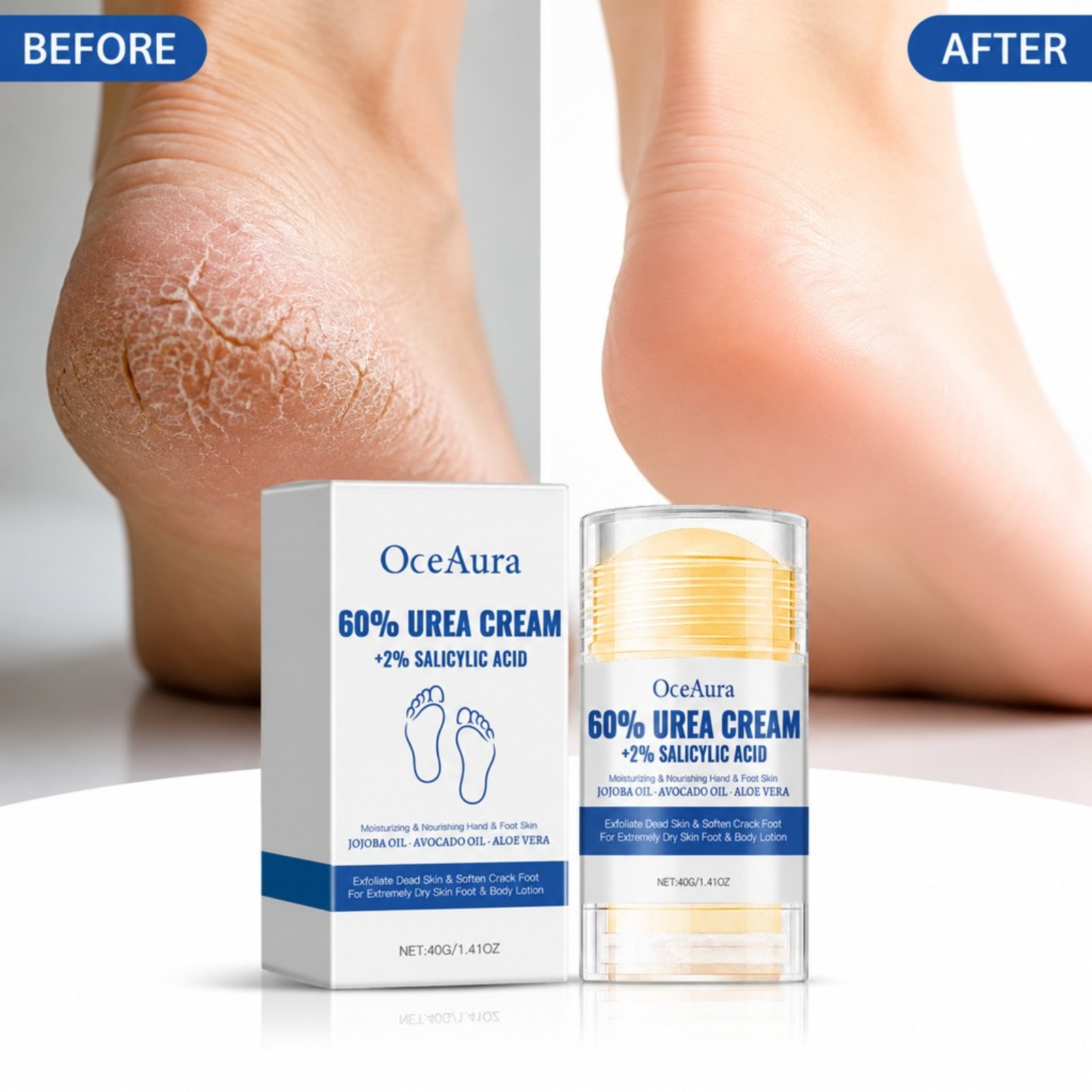Crema en Barra para el Cuidado - Urea Foot Cream reseña y precio
