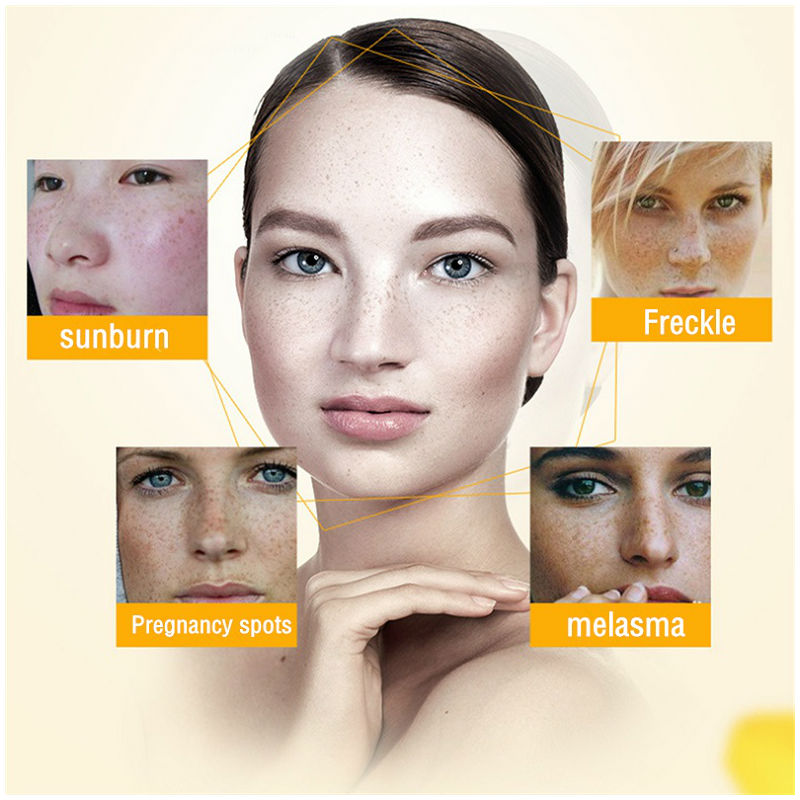 Dimollaure-crema blanqueadora  - Retinol Cream reseña y precio