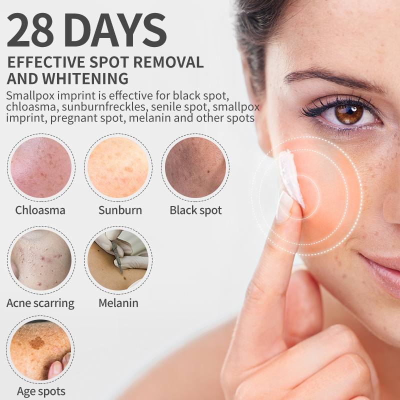 Dimollaure-crema blanqueadora  - Retinol Cream reseña y precio