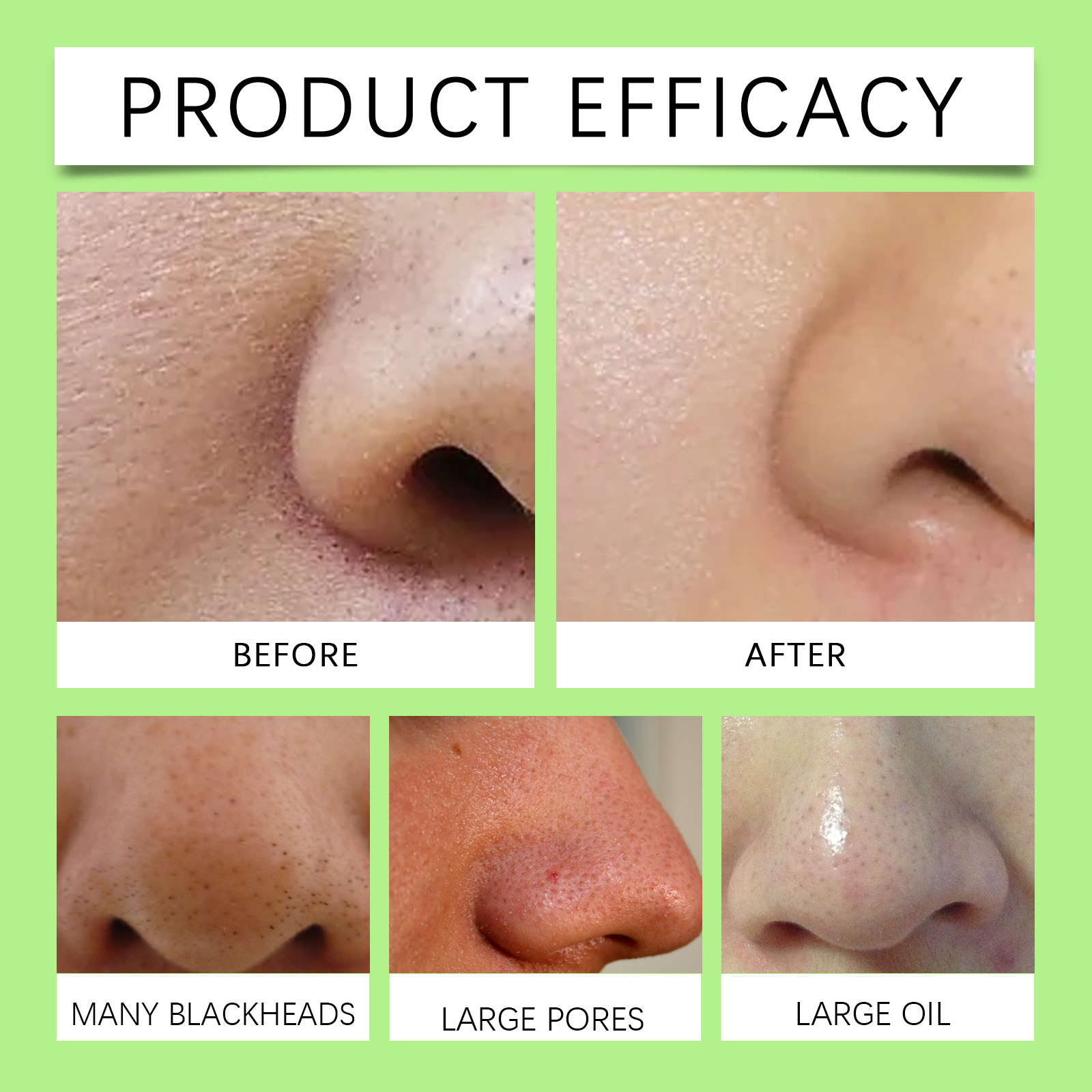 Tiras Nasales de Carbón de Bam - Cleanser Face reseña y precio