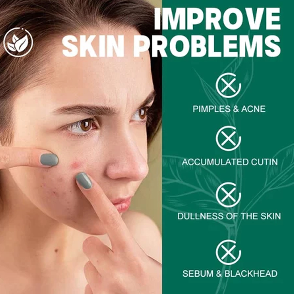 SOME BY MI AHA-BHA-PHA Juego d - Night Cream reseña y precio